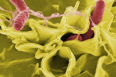 Salmonella Virus