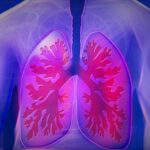 What Is COPD?