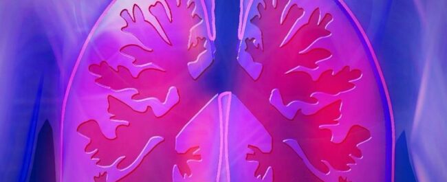 Lungs of a patient with COPD